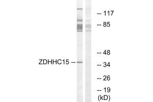 Western Blotting (WB) image for anti-Zinc Finger, DHHC-Type Containing 15 (ZDHHC15) (C-Term) antibody (ABIN1851772) (ZDHHC15 Antikörper  (C-Term))
