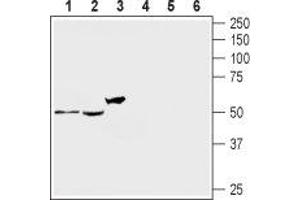 Western blot analysis of rat DRG (lanes 1 and 4), mouse brain (lanes 2 and 5) and human brain neuroblastoma SH-SY5Y (lanes 3 and 6) lysates: - 1-3. (HTR2A Antikörper  (Extracellular))