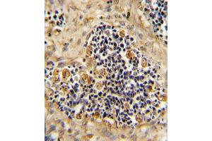 Immunohistochemistry (Paraffin-embedded Sections) (IHC (p)) image for anti-Receptor Tyrosine Kinase-Like Orphan Receptor 2 (ROR2) (AA 19-50), (N-Term) antibody (ABIN392044)