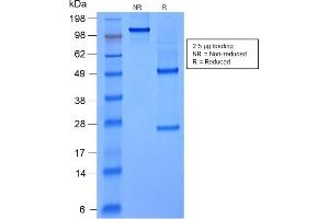 SDS-PAGE Analysis Purified FOXA1 Mouse Recombinant Monoclonal Antibody (rFOXA1/1515). (Rekombinanter FOXA1 Antikörper  (AA 372-472))
