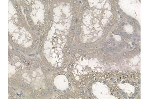 ABIN6265846 and ABIN6272476 at 1/100 staining human normal kidney tissue by IHC-P. (UBE2E3 Antikörper  (N-Term))