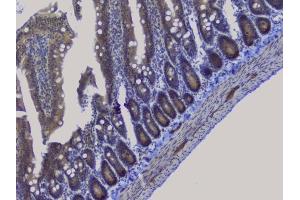 IHC analysis of NRF1 using anti-NRF1 antibody (ABIN6719347). (NRF1 Antikörper  (AA 246-503))