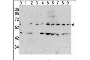 Western blot analysis of phospho c-Myc antibody and human TPA activated HeLa cells/lysate (0: without TPA; 1: 60ug/ml TPA-15min; 2: 60ug/ml-30min; 3: 60ug/ml-45min; 4: 125ug/ml-15min; 5: 125ug/ml-30min; 6: 125ug/ml-45min; 7: 250ug/ml-15min; 8: 250ug/ml-30 (c-MYC Antikörper  (pThr58))