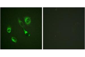 Immunofluorescence analysis of HeLa cells, using EPHA2/3/4 (Phospho-Tyr588/596) antibody. (EPHA2/3 Antikörper  (pTyr588, pTyr596))