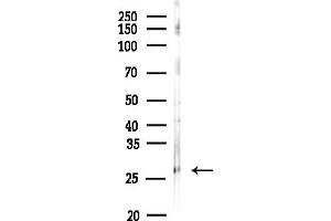 anti-Hemoglobin Alpha 1 + 2 (HBA1,HBA2) (Internal Region) antibody