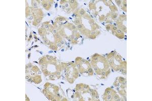 Immunohistochemistry of paraffin-embedded human stomach using SYT4 antibody (ABIN6129135, ABIN6148791, ABIN6148792 and ABIN6223676) at dilution of 1:100 (40x lens). (SYT4 Antikörper  (AA 38-190))