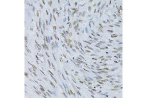Immunohistochemistry of paraffin-embedded human uterus using SNRNP70 antibody. (SNRNP70 Antikörper  (AA 150-250))
