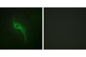 Peptide - +Immunofluorescence analysis of HeLa cells, using Collagen V α1 antibody. (COL5A1 Antikörper)