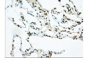 Image no. 7 for anti-Basigin (Ok Blood Group) (BSG) antibody (ABIN1498015) (CD147 Antikörper)