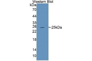 Western blot analysis of the recombinant protein. (PTPRU Antikörper  (AA 1263-1446))