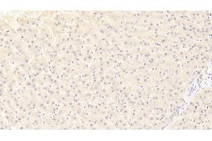 Immunohistochemistry (IHC) image for anti-Fructosamine 3 Kinase (FN3K) (AA 1-309) antibody (ABIN7436612)