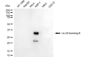 Western blotting analysis using lin-28 homolog B antibody (ABIN7799270).