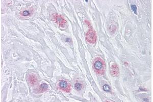 Human Placenta: Formalin-Fixed, Paraffin-Embedded (FFPE) (BUB1B Antikörper  (AA 1-130))