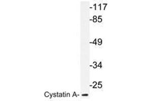 Western blot analysis of Cystatin A antibody in extracts from HT-29 cells. (CSTA Antikörper)