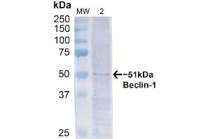 Western blot analysis of Human Cervical cancer cell line (HeLa) lysate showing detection of ~51 kDa Beclin 1 protein using Rabbit Anti-Beclin 1 Polyclonal Antibody (ABIN2868739). (Beclin 1 Antikörper)