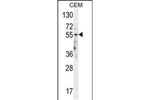 Western blot analysis in CEM cell line lysates (35ug/lane). (HTR3E Antikörper  (AA 126-154))