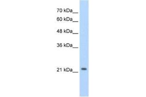 Western Blotting (WB) image for anti-Distal-Less Homeobox Protein 2 (DLX2) antibody (ABIN2460395) (DLX2 Antikörper)