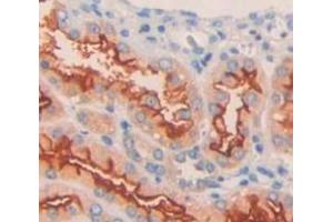 Used in DAB staining on fromalin fixed paraffin- embedded Kidney tissue (KCNJ10 Antikörper  (AA 165-379))