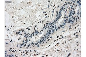 Immunohistochemical staining of paraffin-embedded breast tissue using anti-DHFR mouse monoclonal antibody. (Dihydrofolate Reductase Antikörper)
