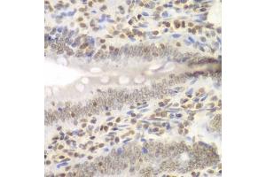 Immunohistochemistry of paraffin-embedded rat Intestine using UHRF2 antibody (ABIN6133264, ABIN6149911, ABIN6149913 and ABIN6217665) at dilution of 1:200 (40x lens). (UHRF2 Antikörper  (AA 441-622))