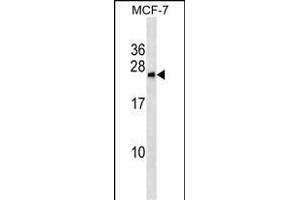 Western Blotting (WB) image for anti-BCL2/adenovirus E1B 19kDa Interacting Protein 1 (BNIP1) (AA 26-55), (N-Term) antibody (ABIN1539242)