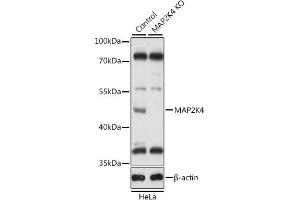 Western blot analysis of extracts from normal (control) and MK4 knockout (KO) HeLa cells, using MK4 antibody (ABIN7268641) at 1:1000 dilution. (MAP2K4 Antikörper  (AA 300-399))