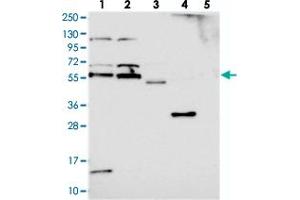 Western blot analysis of Lane 1: RT-4, Lane 2: U-251 MG, Lane 3: Human Plasma, Lane 4: Liver, Lane 5: Tonsil with ACRBP polyclonal antibody  at 1:250-1:500 dilution.
