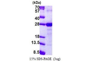 SDS-PAGE (SDS) image for Lymphocyte Antigen 6 Complex, Locus G6F (LY6G6F) (AA 17-235) protein (His tag) (ABIN5853149)