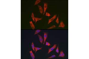 Immunofluorescence analysis of HeLa cells using MYO10 antibody (ABIN6128319, ABIN6144271, ABIN6144274 and ABIN6216113) at dilution of 1:350. (Myosin X Antikörper  (AA 845-944))