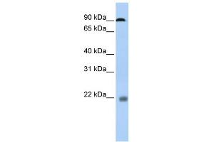 WB Suggested Anti-NFATC1 Antibody Titration:  0.