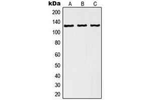 Western blot analysis of RANBP6 expression in A549 (A), K562 (B), human kidney (C) whole cell lysates. (RANBP6 Antikörper  (Center))