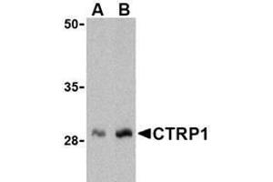 Western blot analysis of CTRP1 in human kidney cell lysate with AP30247PU-N CTRP1 antibody at (A) 1 and (B) 2 μg/ml. (C1QTNF1 Antikörper  (N-Term))
