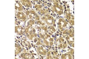 Immunohistochemistry of paraffin-embedded human gastric using HSPE1 antibody. (HSPE1 Antikörper  (AA 1-102))