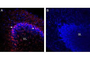 Expression of VGAT in mouse cerebellum.