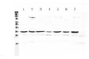 Western blot analysis of UCP2 using anti-UCP2 antibody . (UCP2 Antikörper  (Middle Region))
