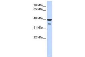 Image no. 1 for anti-Zinc Finger Protein 785 (ZNF785) (N-Term) antibody (ABIN6742921) (ZNF785 Antikörper  (N-Term))