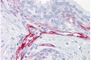Anti-Vimentin antibody IHC staining of human prostate. (Vimentin Antikörper)