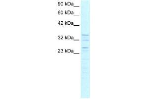 WB Suggested Anti-ZNF385 Antibody Titration: 0. (ZNF385A Antikörper  (C-Term))
