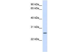 WB Suggested Anti-UNC50 Antibody Titration:  0. (UNC50 Antikörper  (N-Term))