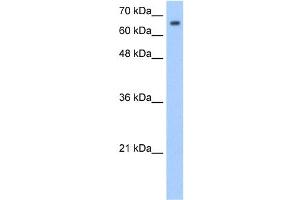 WB Suggested Anti-SYVN1 Antibody Titration:  1. (SYVN1 Antikörper  (Middle Region))