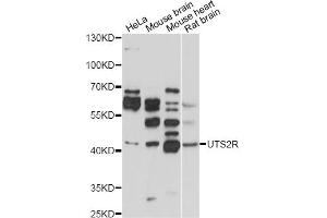 Western blot analysis of extracts of various cell lines, using UTS2R antibody (ABIN1875304) at 1:1000 dilution.
