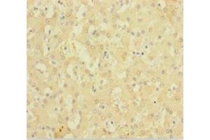 Immunohistochemistry of paraffin-embedded human liver tissue using ABIN7143220 at dilution of 1:100 (Diazepam Binding Inhibitor Antikörper  (AA 2-105))
