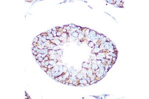 Immunohistochemistry of paraffin-embedded rat testis using Muscarinic AChR M2 (Muscarinic AChR M2 ) Rabbit mAb (ABIN7266346) at dilution of 1:100 (40x lens). (Muscarinic Acetylcholine Receptor M2 Antikörper)