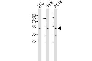 Western blot analysis of lysates from 293, Hela, A549 cell line (from left to right), using CBX8 Antibody (C-term) (ABIN6242216 and ABIN6577075). (CBX8 Antikörper  (C-Term))