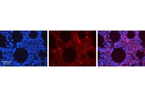 Rabbit Anti-EPOR Antibody   Formalin Fixed Paraffin Embedded Tissue: Human Bone Marrow Tissue Observed Staining: Cytoplasm, Plasma membrane Primary Antibody Concentration: 1:100 Other Working Concentrations: N/A Secondary Antibody: Donkey anti-Rabbit-Cy3 Secondary Antibody Concentration: 1:200 Magnification: 20X Exposure Time: 0. (EPOR Antikörper  (N-Term))