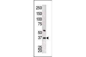 Western Blotting (WB) image for anti-Twinfilin, Actin-Binding Protein, Homolog 2 (Drosophila) (TWF2) (AA 320-349), (C-Term) antibody (ABIN1882143)