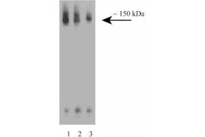 Western blot analysis of CD100 on a Jurkat cell lysate (Human T-cell leukemia, ATCC TIB-152). (SEMA4D/CD100 Antikörper  (AA 721-861))