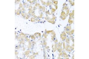 Immunohistochemistry of paraffin-embedded human stomach using DDX39A antibody (ABIN6131590, ABIN6139489, ABIN6139491 and ABIN6223963) at dilution of 1:100 (40x lens). (DDX39 Antikörper  (AA 178-427))