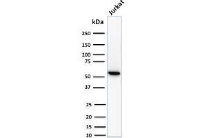Western Blot Analysis of human Jurkat cell lysate using Topo I, MT Mouse Monoclonal Antibody (TOP1MT/488).