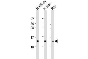 Western Blotting (WB) image for anti-NADH Dehydrogenase (Ubiquinone) Fe-S Protein 5, 15kDa (NADH-Coenzyme Q Reductase) (NDUFS5) (AA 5-36) antibody (ABIN6244089)